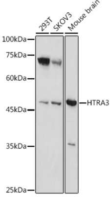 Western Blot: HtrA3 AntibodyAzide and BSA Free [NBP3-04967]